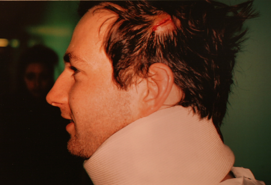 Léo Berne "L'accident"